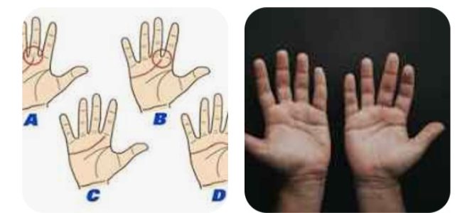 
					Fenomena Garis Tangan, Campur Tangan dan Buah Tangan Dalam Proses (Ilustrasi)