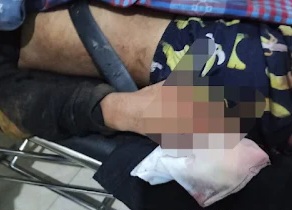Korban Perkelahian Gara-gara Sawit. (Ist)