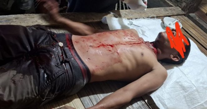 
					Penumpang Begal Tukang Ojeg. (Ist)